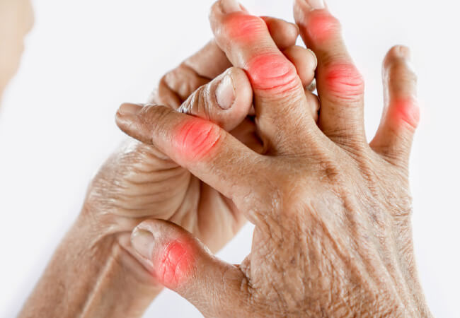 Put An End To Your Arthritis Pain For Good