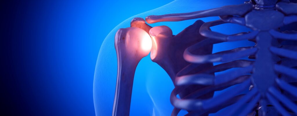 Shoulder pain relief Arlington, VA