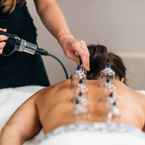 cupping-MMA-&-Sports-Rehab-Arlington-VA